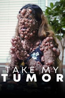 imagen: Take My Tumor